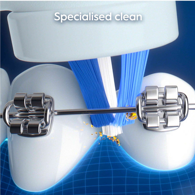 Periuță de dinți electrică Oral-B iO My Way Teens 818626, Gri