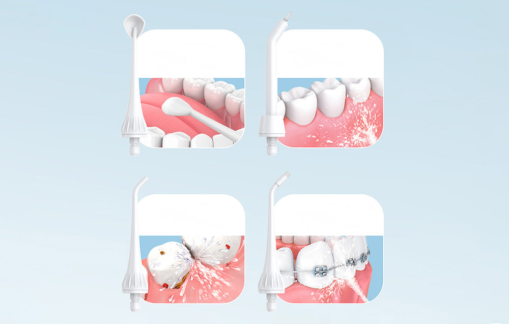 Irigator dentar FairyWill 5020E, 3 moduri, 300 ml, alb