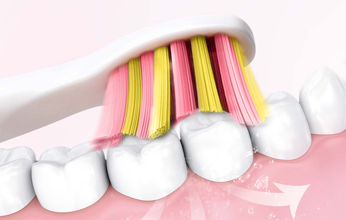 Periuță de dinți electrică cu ultrasunete FairyWill FW-507 cu 8 accesorii și husă, roz