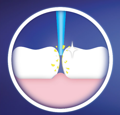 Cap de periuță de dinți electrică Oral-B Interspace IP17-2, 2 buc. 